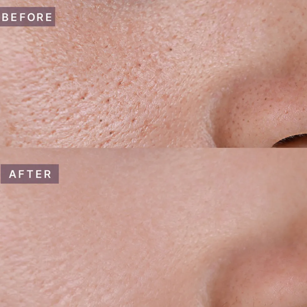 Pot Pore Tightening Podo Ampoule