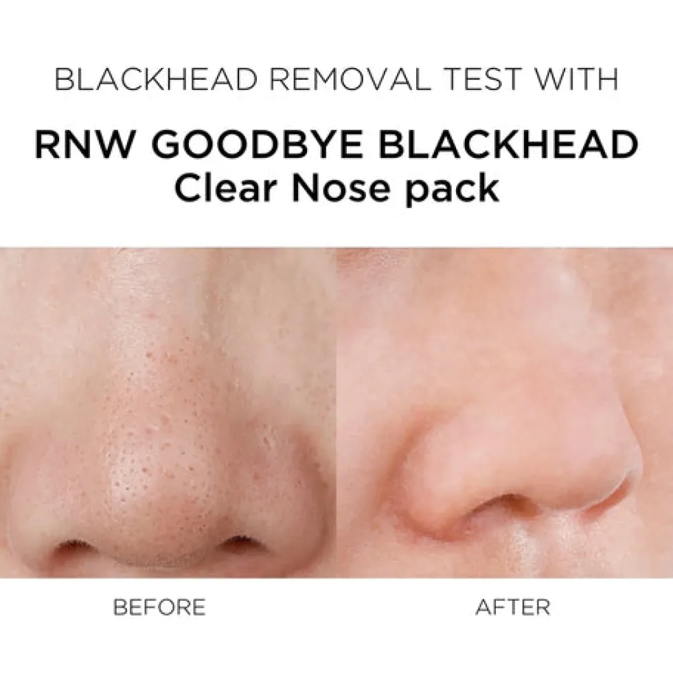 2 STEP Clear Nose Pack